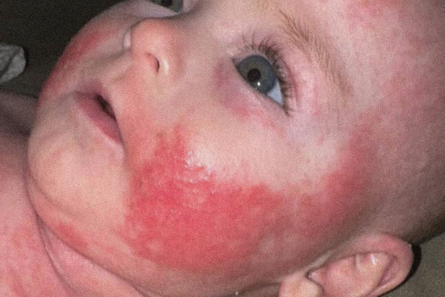 She Wasn’t Gaining Weight. Her Skin Was Raw. Now She’s Thriving! Sheridan and Her Baby’s Story. | 157