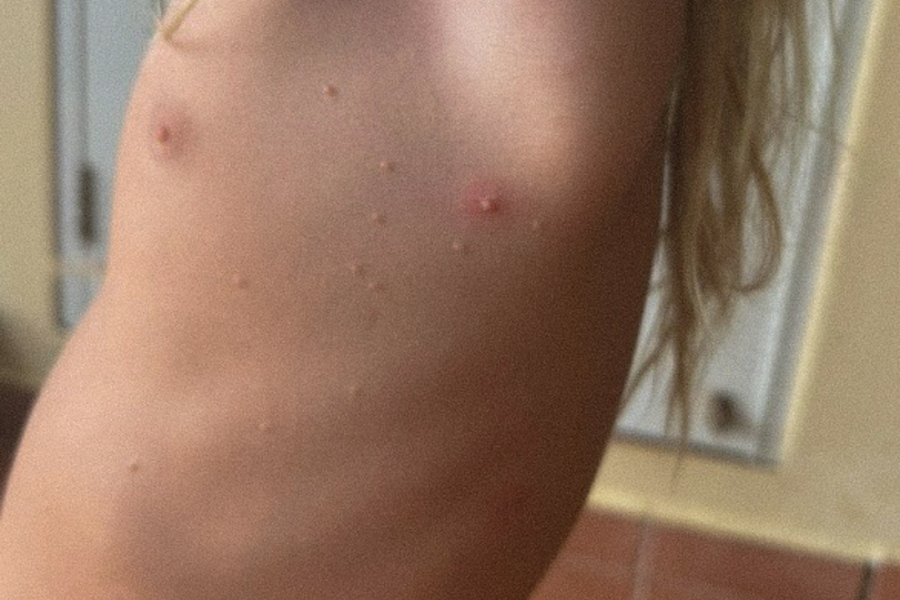 The Parasites Came Out of His Skin. Abi's Story of Trust and Healing | 156