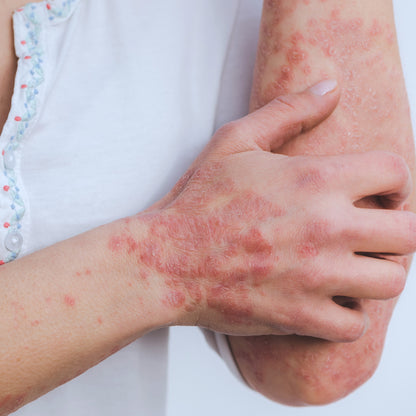 Histamine Regulation Bundle