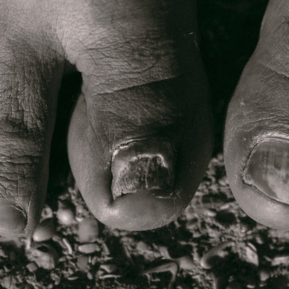 Candida, H.Pylori and SIBO Healing Bundle